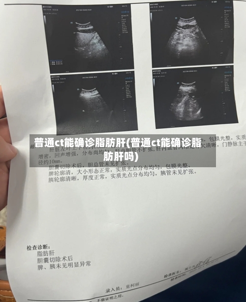 普通ct能确诊脂肪肝(普通ct能确诊脂肪肝吗)-第2张图片