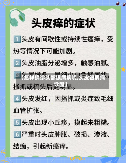 【怎样确诊头部银屑病呢,头皮银屑病诊断】