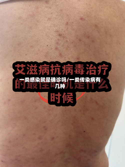 一类感染就是确诊吗/一类传染病有几种