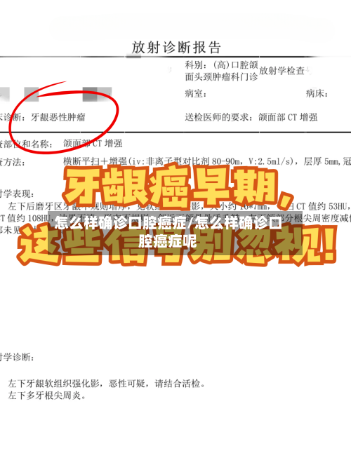 怎么样确诊口腔癌症/怎么样确诊口腔癌症呢